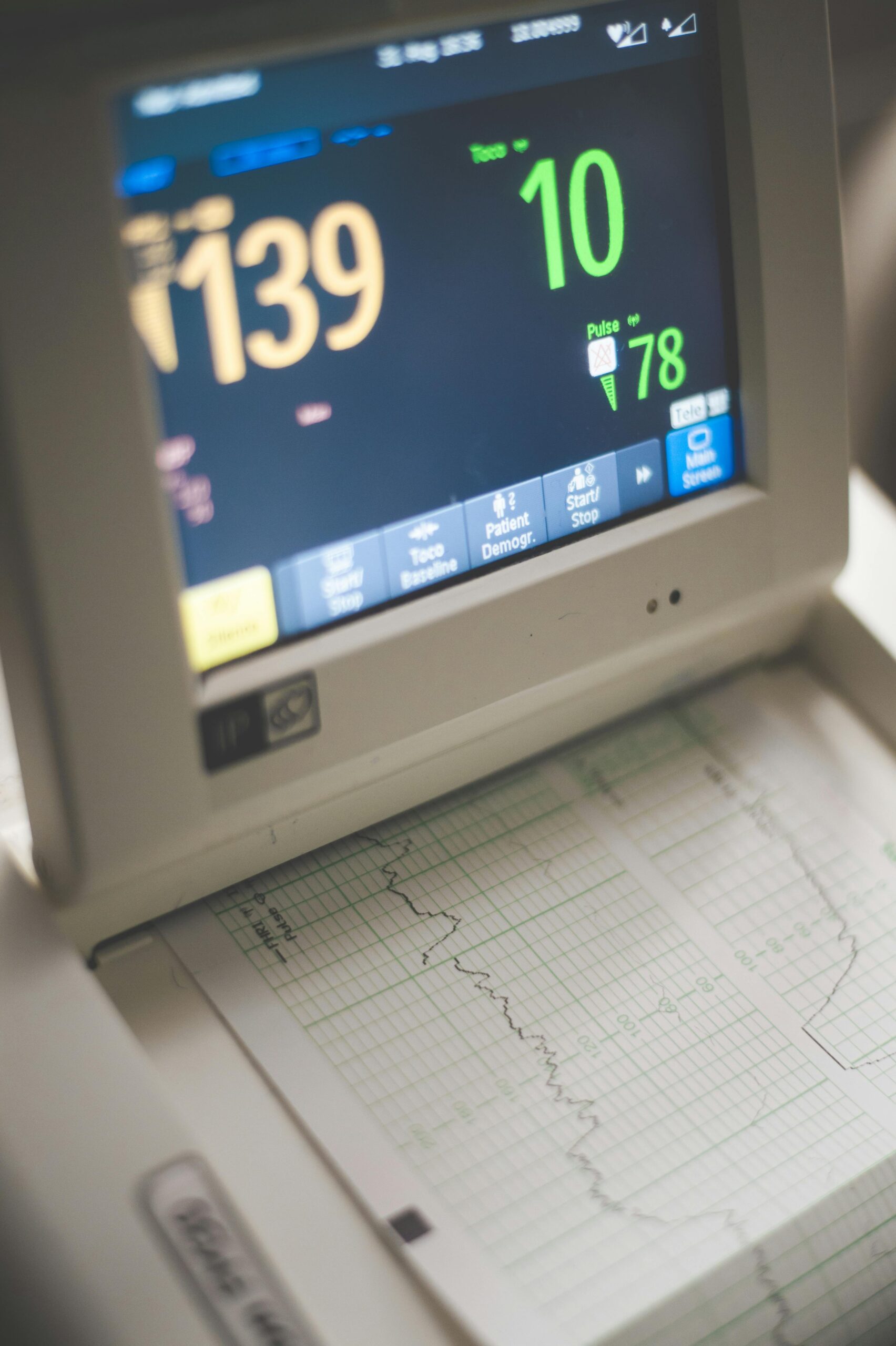 Close-up of an ECG monitor displaying heart rate and pulse data in a medical setting.